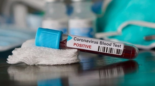 Bir haftada 485 çocuk daha koronavirüsten hasta oldu