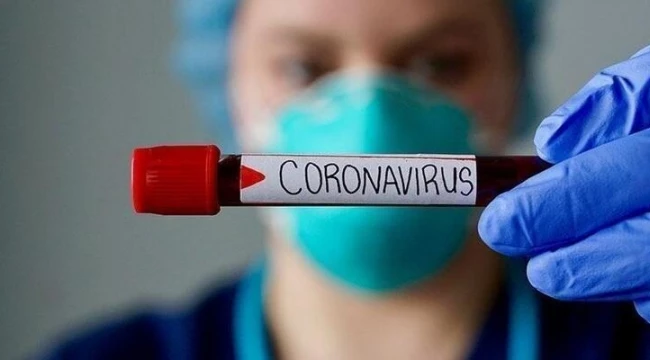 Koronavirüs Günlük (29 Ağustos) Vaka Sayıları Açıklandı, Ölü Sayısı 250 Barajını Aştı