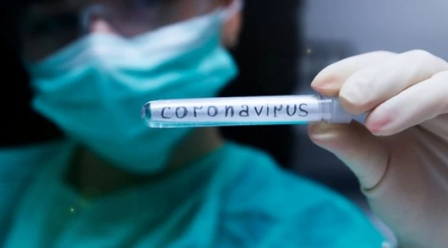 Japonya Koronavirüs (Covid-19) İçin İlaç 