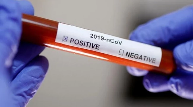 Günlük Koronavirüs Vaka Tablosu: Pozitif Test Sayısı 72.555 Hayatını Kaybeden 181 Kişi Çıktı